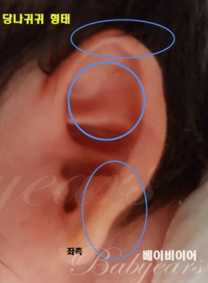 당나귀귀1