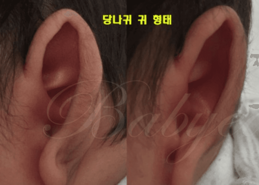 당나귀귀2